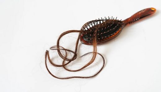 Injerto Capilar: Todo sobre la técnica FUE